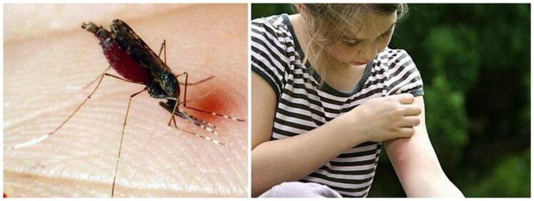 Ketulan yang menyakitkan selepas gigitan nyamuk boleh menjadi gejala cacing jantung